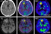 CT MRI 